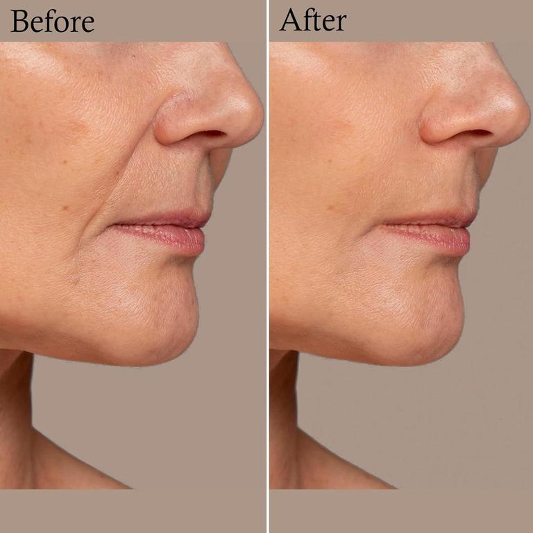 Face wrinkle Patches - Reusable Anti-Wrinkle Pads for Face - Skincare Pads to Smooth Eye, Mouth, Forehead - Clear Anti-Wrinkle Treatment for Overnight Lift - Train Facial Muscles to Reduce Fine Lines, Frown Lines, Smile Lines - 5