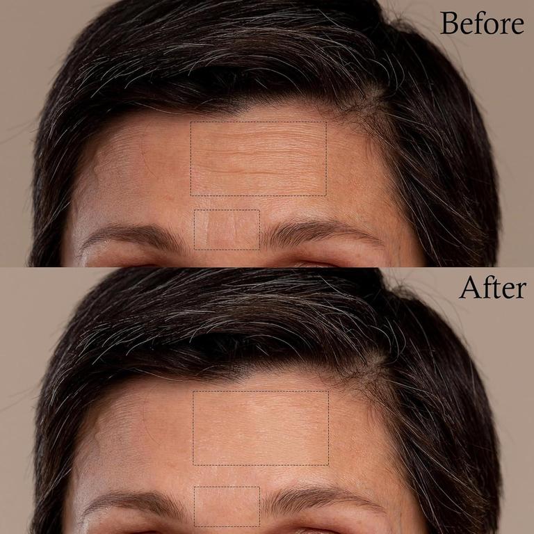 Face wrinkle Patches - Reusable Anti-Wrinkle Pads for Face - Skincare Pads to Smooth Eye, Mouth, Forehead - Clear Anti-Wrinkle Treatment for Overnight Lift - Train Facial Muscles to Reduce Fine Lines, Frown Lines, Smile Lines - 6