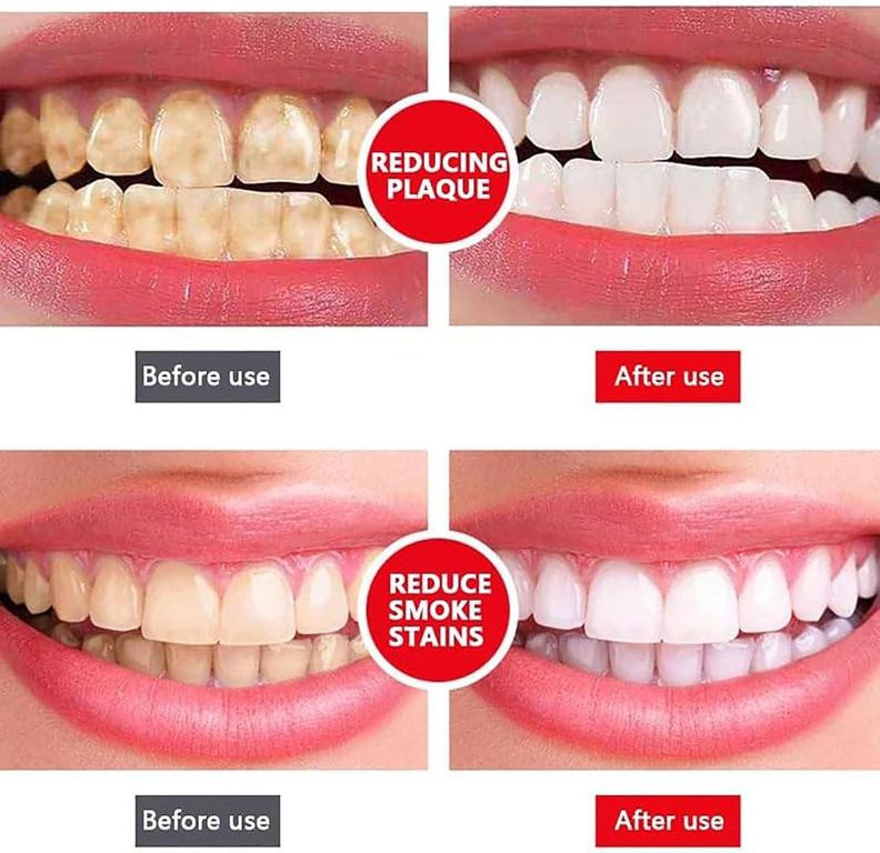 Yayashi Sp 4 Toothpaste Sp 4 Probiotic Toothpaste Yayashi Sp 4 Toothpaste Fresh Breath Toothpaste Natural Tooth Whitener For All Oral Concerns Brighter - 8