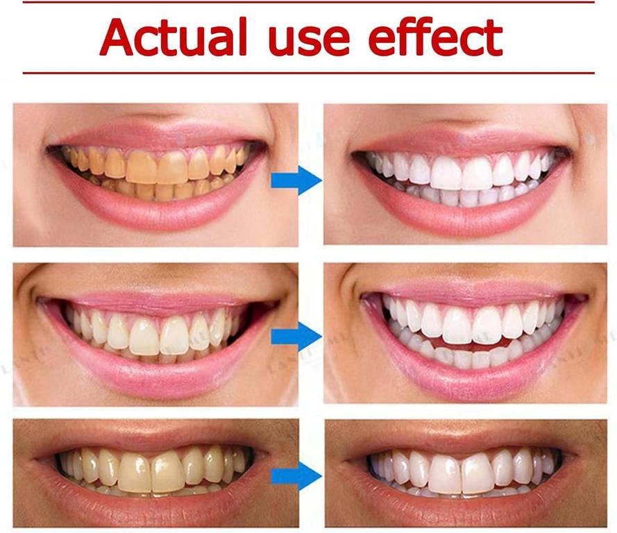 Yayashi Sp 4 Toothpaste Sp 4 Probiotic Toothpaste Yayashi Sp 4 Toothpaste Fresh Breath Toothpaste Natural Tooth Whitener For All Oral Concerns Brighter - 7
