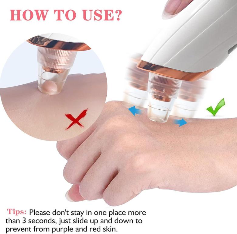 Face Value 5 in 1 Electric Blackhead Remover Machine Rechargeable Done Extractor Face Rechargeable Pore Cleaner Durable Useful and Practical Nice Design Practical Design and Durable - 2