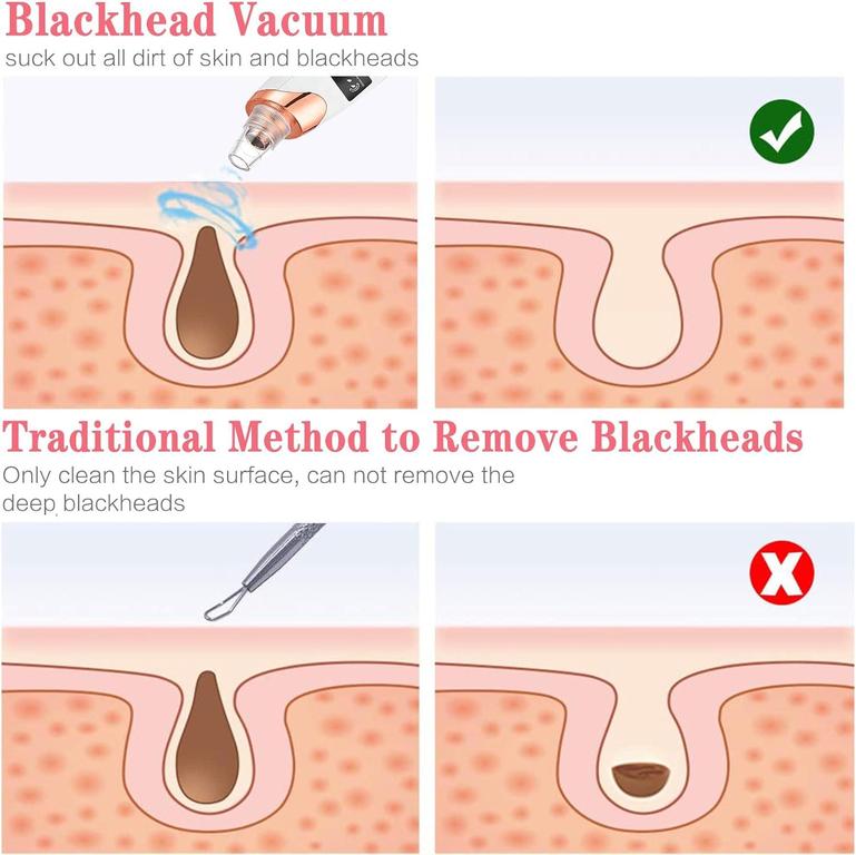 Face Value 5 in 1 Electric Blackhead Remover Machine Rechargeable Done Extractor Face Rechargeable Pore Cleaner Durable Useful and Practical Nice Design Practical Design and Durable - 4